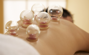 A person lying face down with several glass cupping therapy cups on their back, experiencing one of the unique types of massage in a relaxing treatment setting. - Ihloff Salon and Day Spa